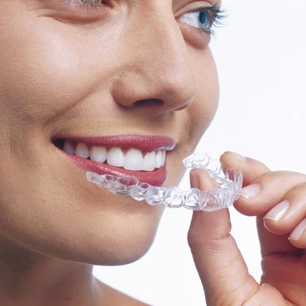 INVISALIGN