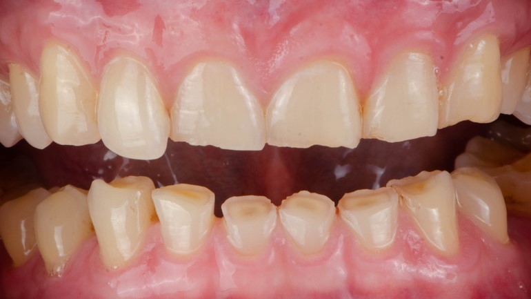 Diseño de Sonrisa